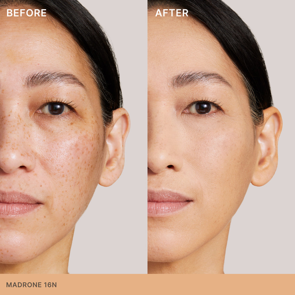 Before and after comparison of a woman's facial skin treatment, showcasing clearer skin post-treatment.