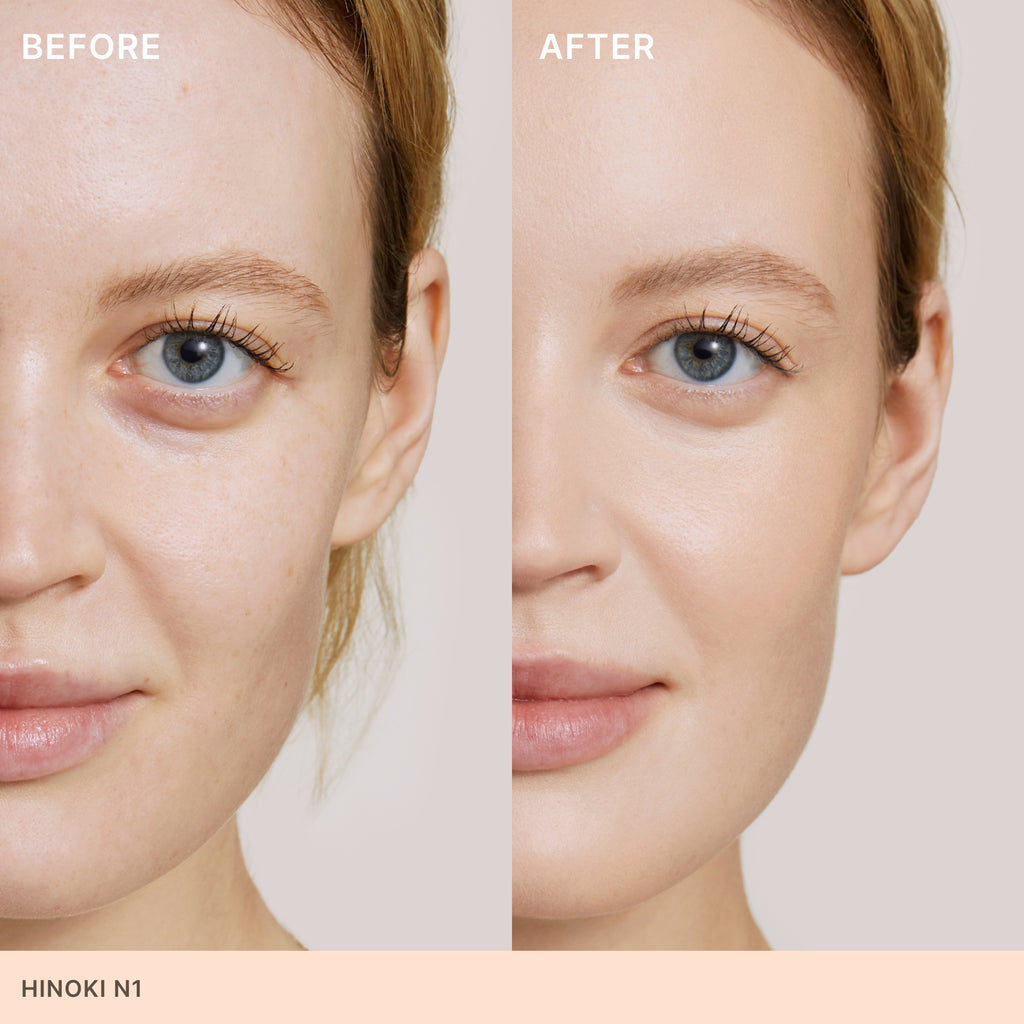 Comparison of a woman's face before and after cosmetic treatment, highlighting clearer skin and reduced imperfections.