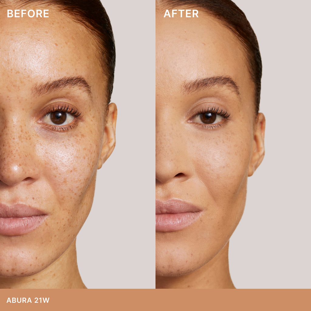 Side-by-side comparison of a woman's face before and after cosmetic treatment, showcasing clearer skin and subtle makeup application.