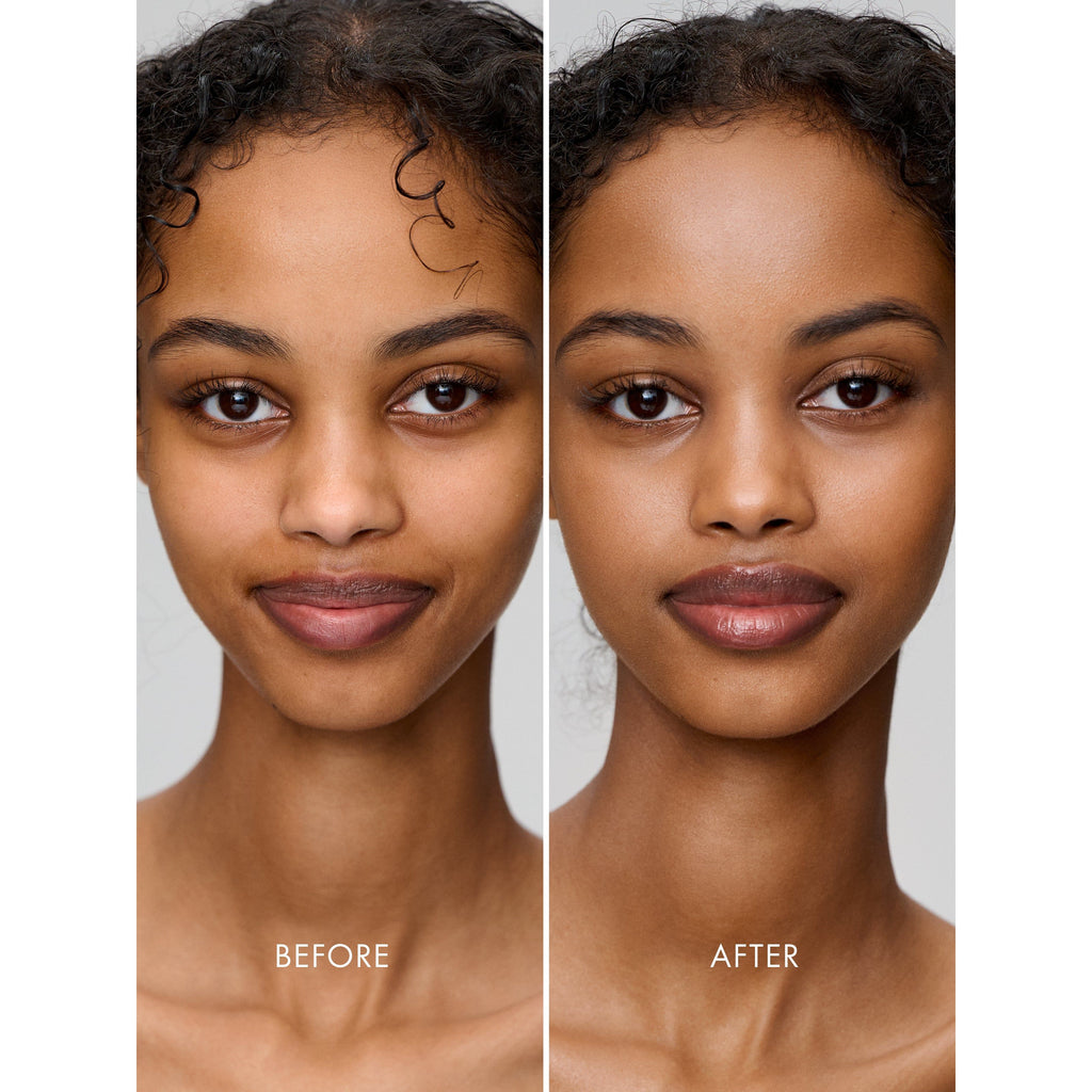 Comparison of a woman's facial appearance before and after cosmetic enhancement.