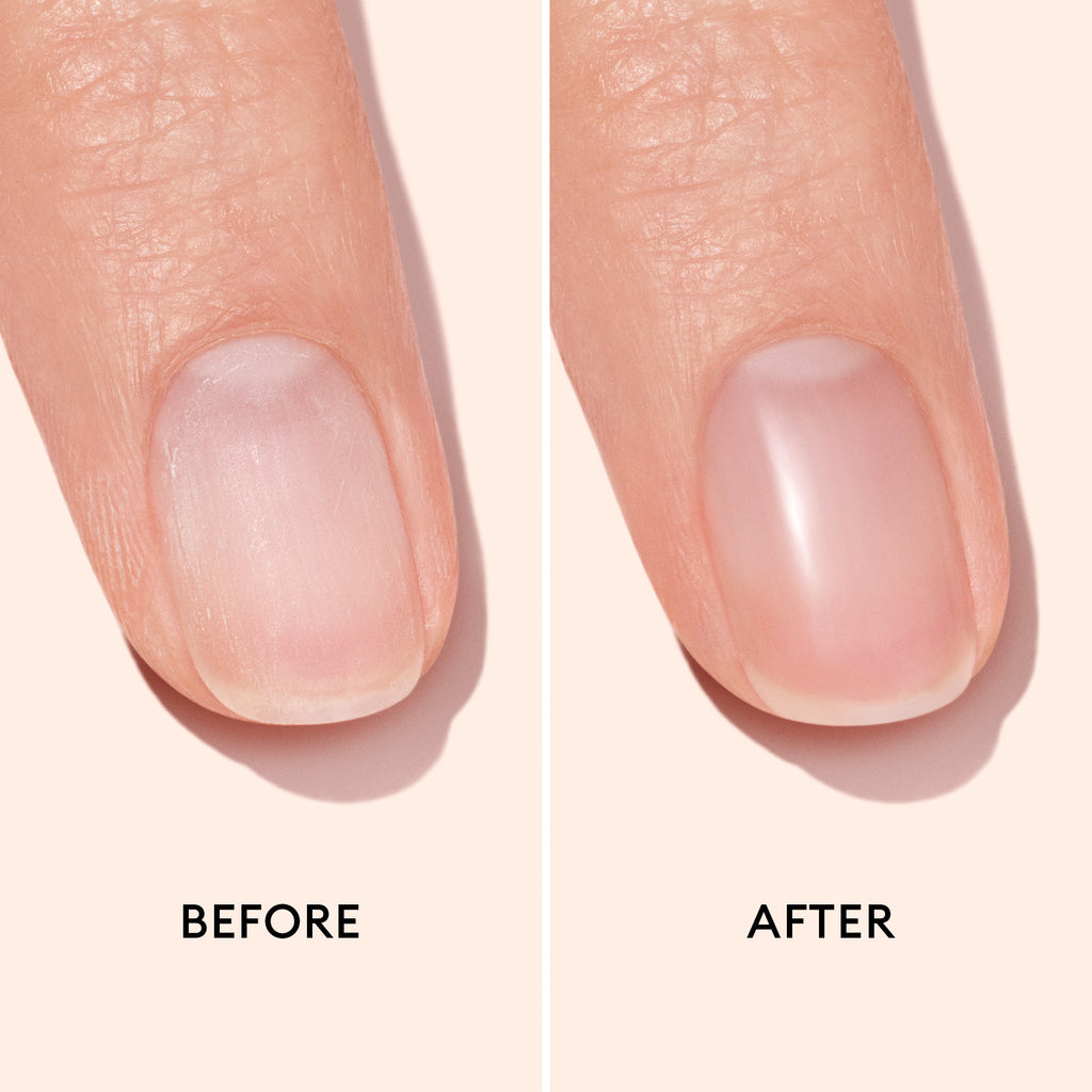 Before and after comparison of nail on a plain background