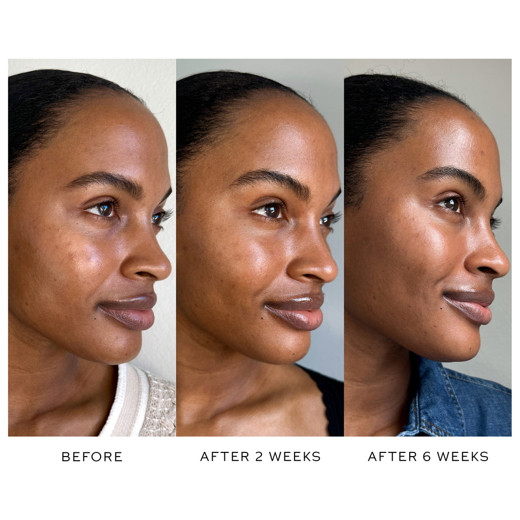 Three side-by-side photos of a woman's face showing skin improvement over time using Westman Atelier Suprême C serum: "before," "after 2 weeks," and "after 6 weeks