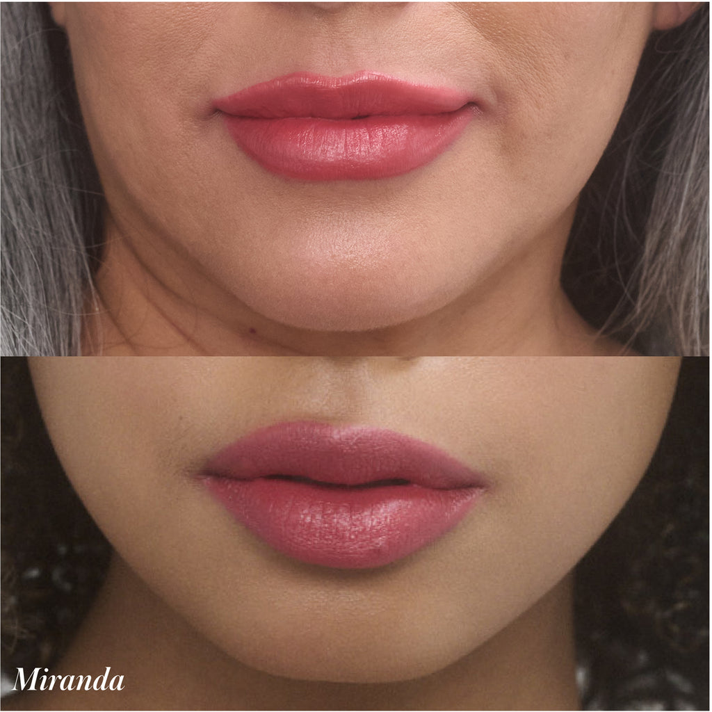 Before and after close-up of a woman's lips, possibly post cosmetic treatment.