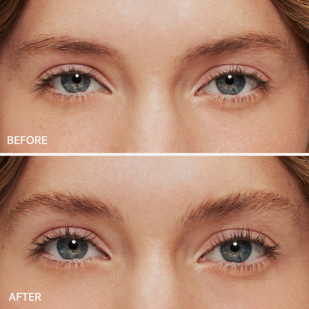 Comparison of a person's eyes before and after a cosmetic treatment.