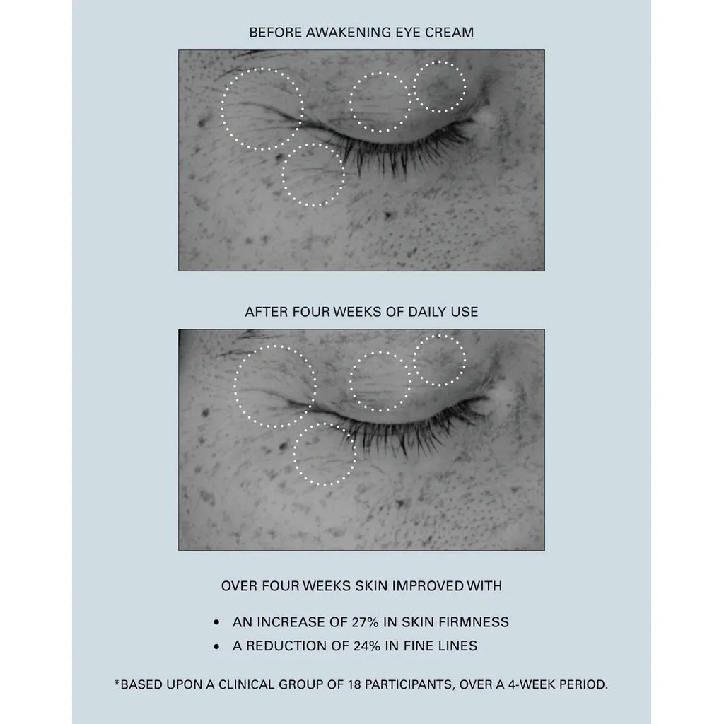 Before and after close-up images showing the effects of using an eye cream for four weeks, with the lower image displaying a 27% increase in skin firmness.