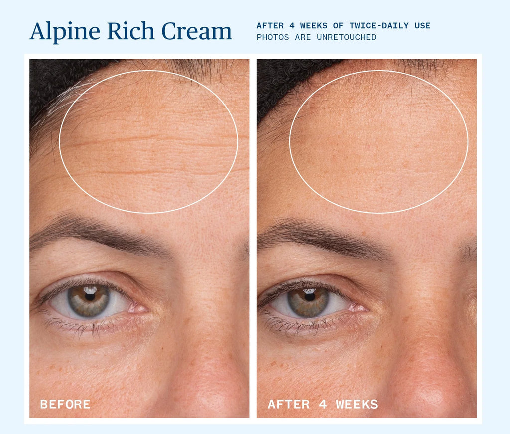 Wrinkle Reduction. Alpine Rich Cream is our richest cream yet, infused with alpine &amp; forest actives to hydrate deeply, support the skin barrier, and soften the look of fine lines. 