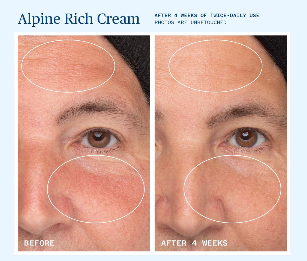 Alpine Rich Cream is our richest cream yet, infused with alpine &amp; forest actives to hydrate deeply, support the skin barrier, and soften the look of fine lines. 