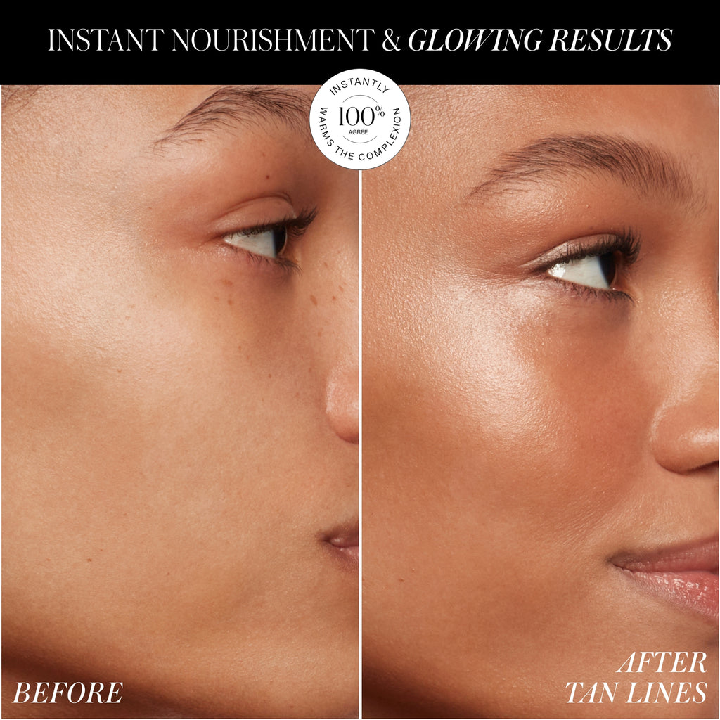 Before and after comparison of skin showing reduced tan lines and improved glow following a skincare treatment.