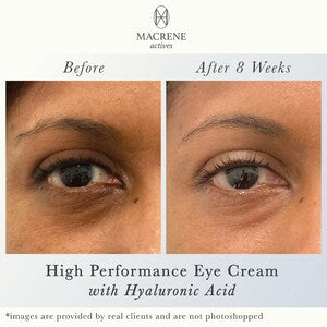 MACRENE ACTIVES.The High Performance Eye Cream Is a complete formula for the delicate skin of the eye area that addresses the signs of aging and under-eye circles