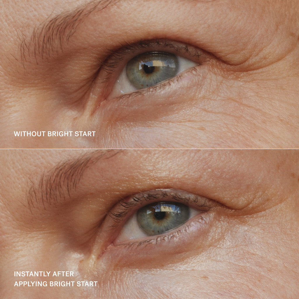 Before and after comparison of a skincare product effect on eye wrinkles.