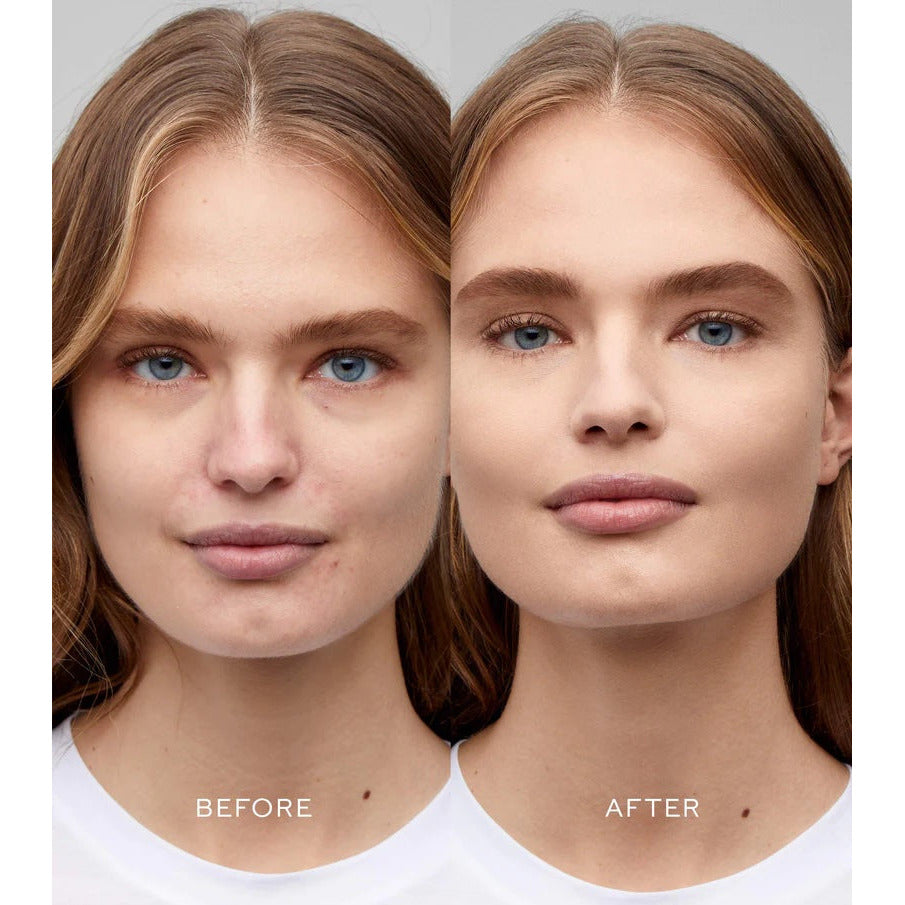 Before and after comparison of a woman's facial skin treatment.